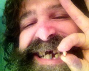 Mick Foley smiling, showing his teeth.